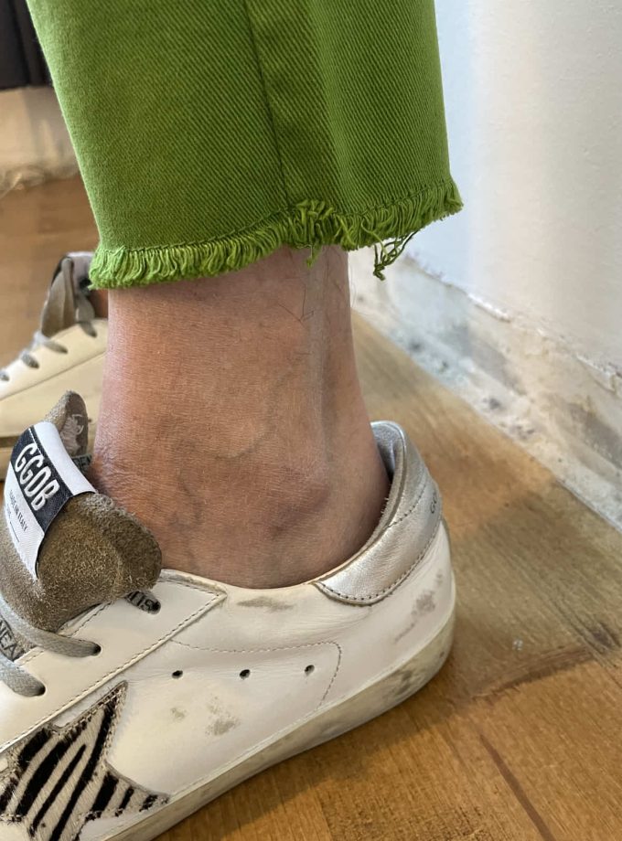 Jeans skinny  Meme Road